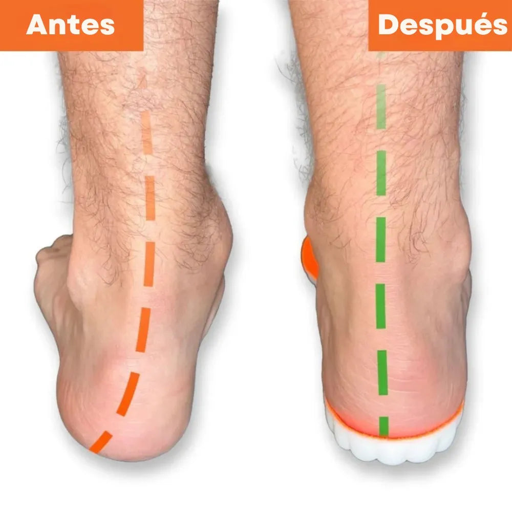 Syruna™ – Plantillas ortopédicas